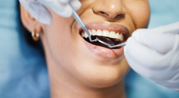Best Emergency Root Canal Treatment in Fritch, TX