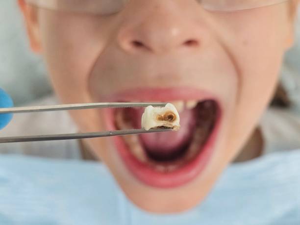 Best Pediatric Emergency Dentist in Fritch, TX
